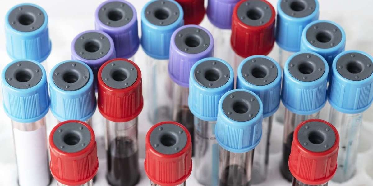 Human Lipoprotein ELISA Kit
