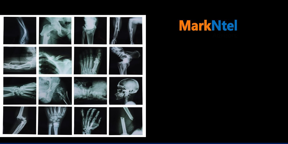 Vietnam X-Ray Market Future Business Opportunities 2025-2030 | MarkNtel